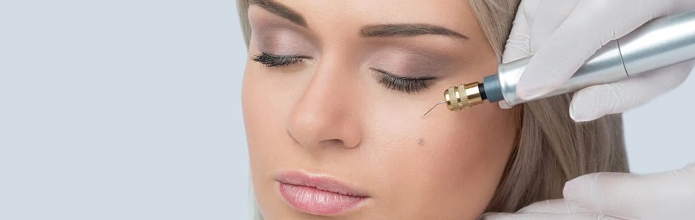 rita-clinic-fibroblast-4 - Rita Clinic